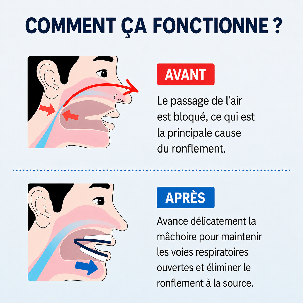 Lullisy™ – Dispositif Anti-Ronflement