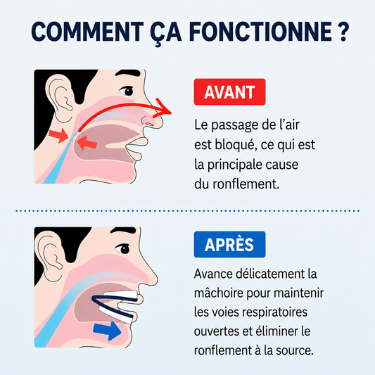 Lullisy™ – Dispositif Anti-Ronflement