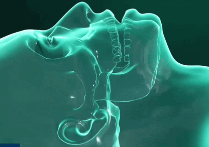 Lullisy™ – Dispositif Anti-Ronflement